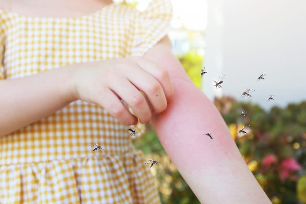 Kenali Gejala DBD (Demam Berdarah Dengue) dan Fasenya