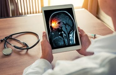 Apa Itu Neurologi?
