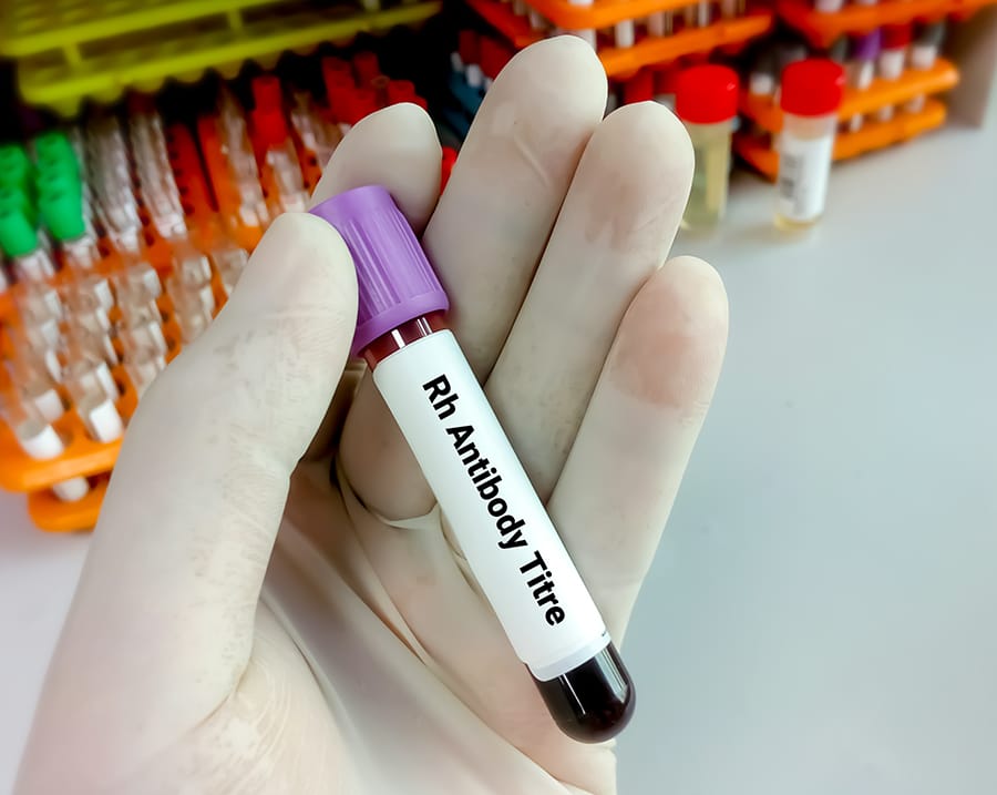 Titer Antibodi Covid-19: Pengertian dan Fungsinya