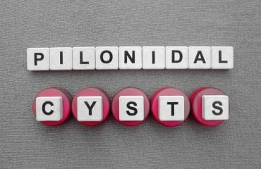 kista pilonidal