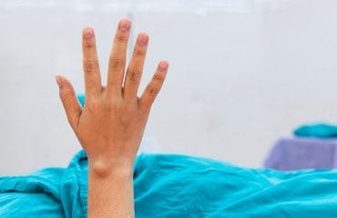 Bahaya Kista Ganglion yang Perlu Diketahui