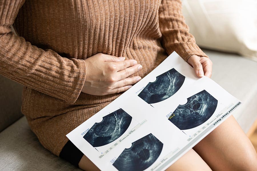 Kelenjar bartholin terletak di antara vagina dan vulva. 