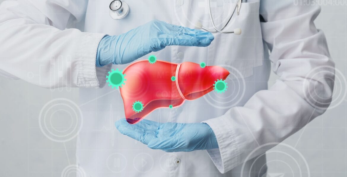 bahaya hepatitis akut