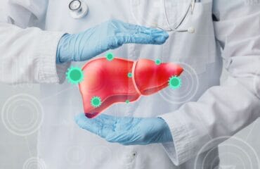bahaya hepatitis akut