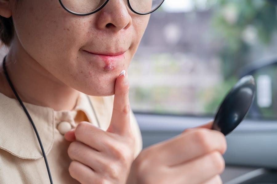 Apakah herpes berbahaya