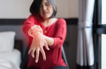 Bagaimana Cara Mengatasi Penyakit Asam Urat?