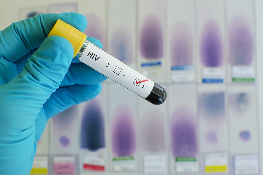 Bagaimana Cara Menghindari Penyakit HIV dan AIDS