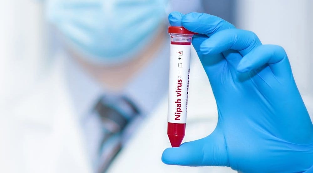Apa Itu Virus Nipah? Penyebab, Gejala, hingga Pengobatannya