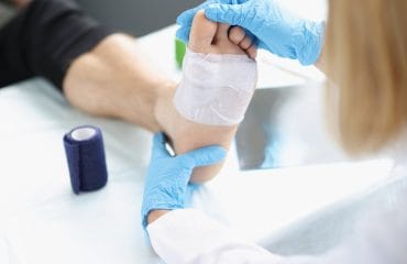 Perawatan Luka Diabetes yang Tepat agar Cepat Kering