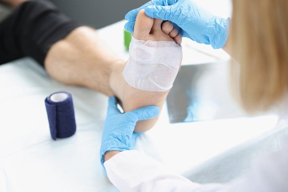 Perawatan Luka Diabetes yang Tepat agar Cepat Kering
