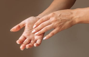 Telapak Tangan Gatal