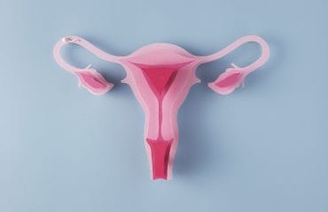 gejala pcos pada wanita