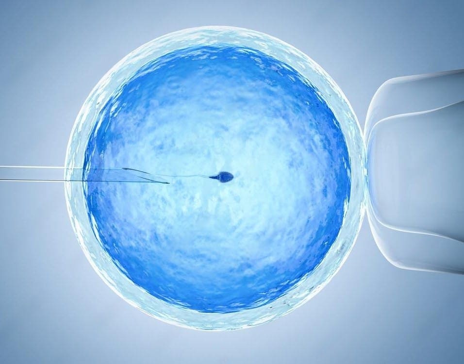 bayi tabung IVF