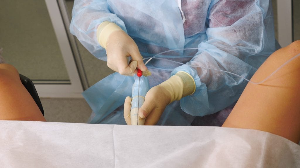 Inseminasi Buatan