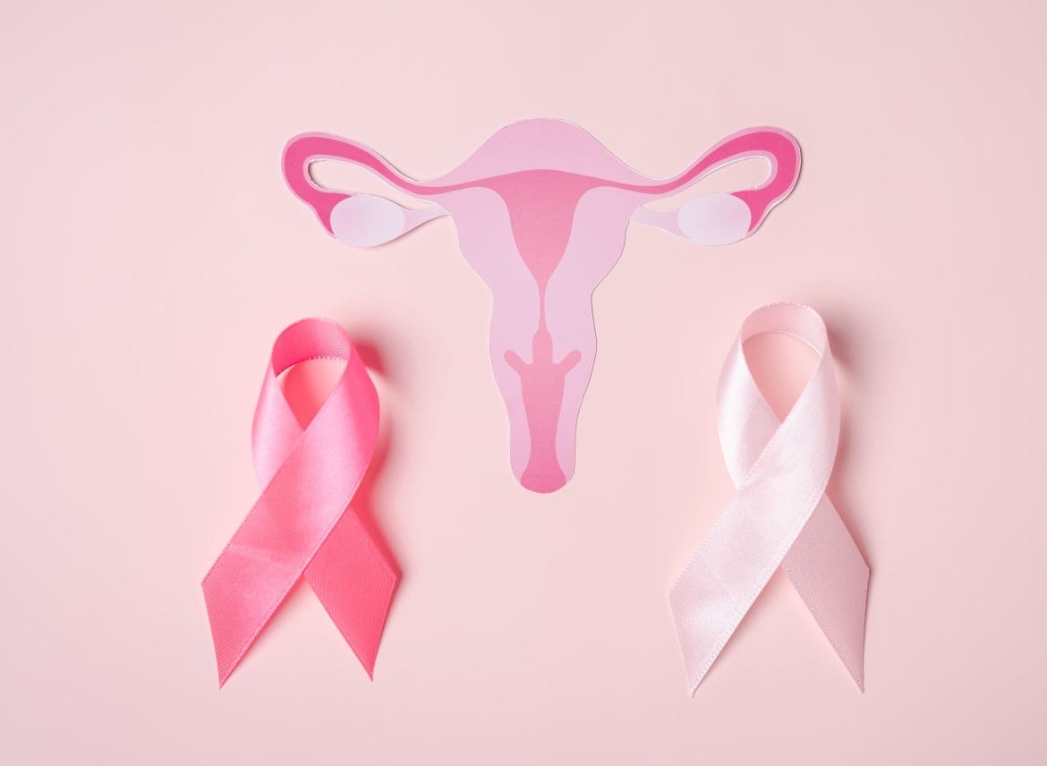 Perbedaan PCO dan PCOS