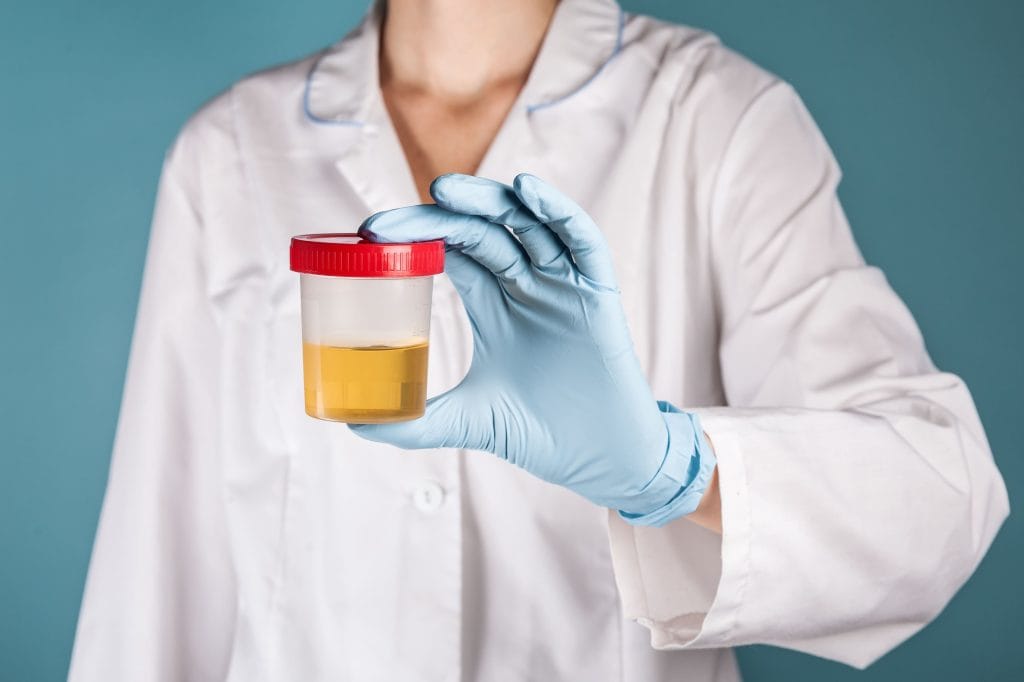 Ciri-ciri urine tidak normal 