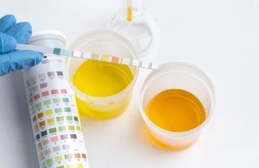 ciri-ciri urine orang yang sehat