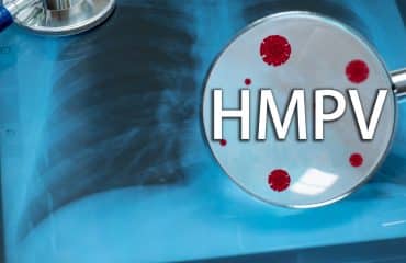 cara mengatasi virus hmpv