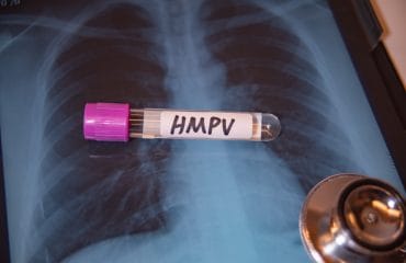 gejala virus hmpv