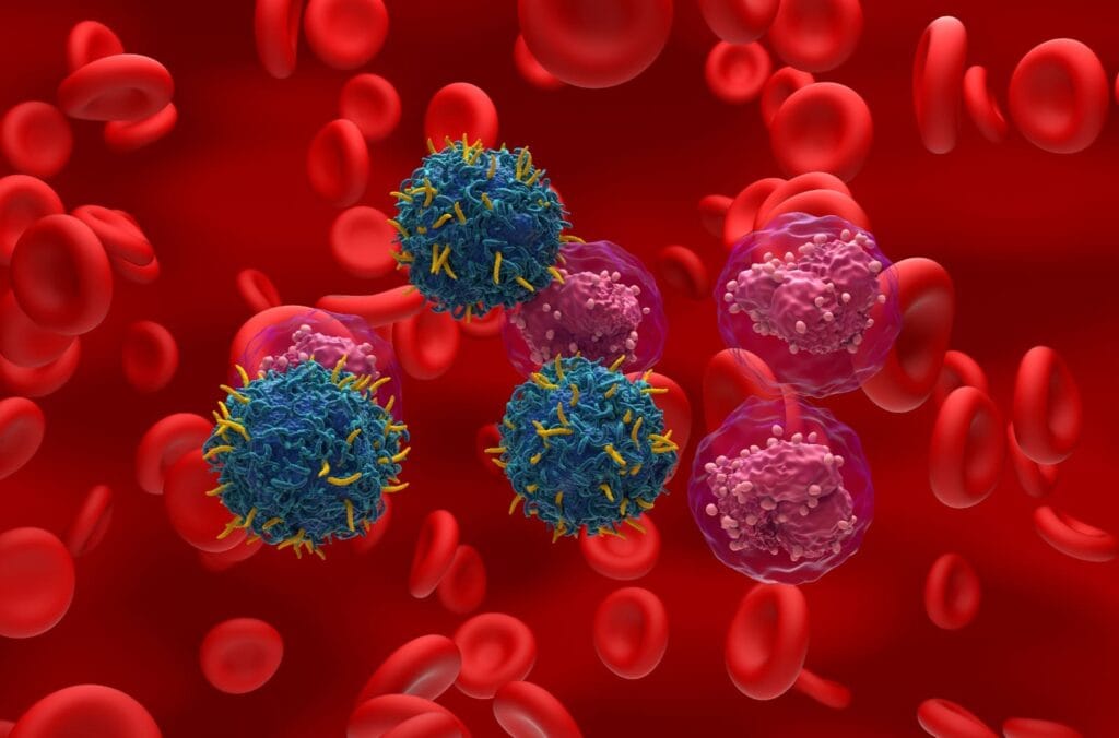 jenis leukemia