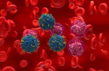 jenis leukemia