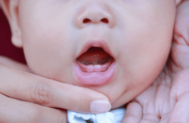 bayi tumbuh gigi