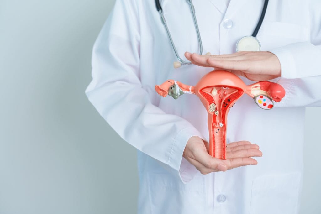penyakit sistem reproduksi wanita