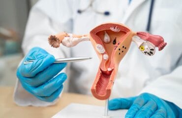 Kanker Endometrium