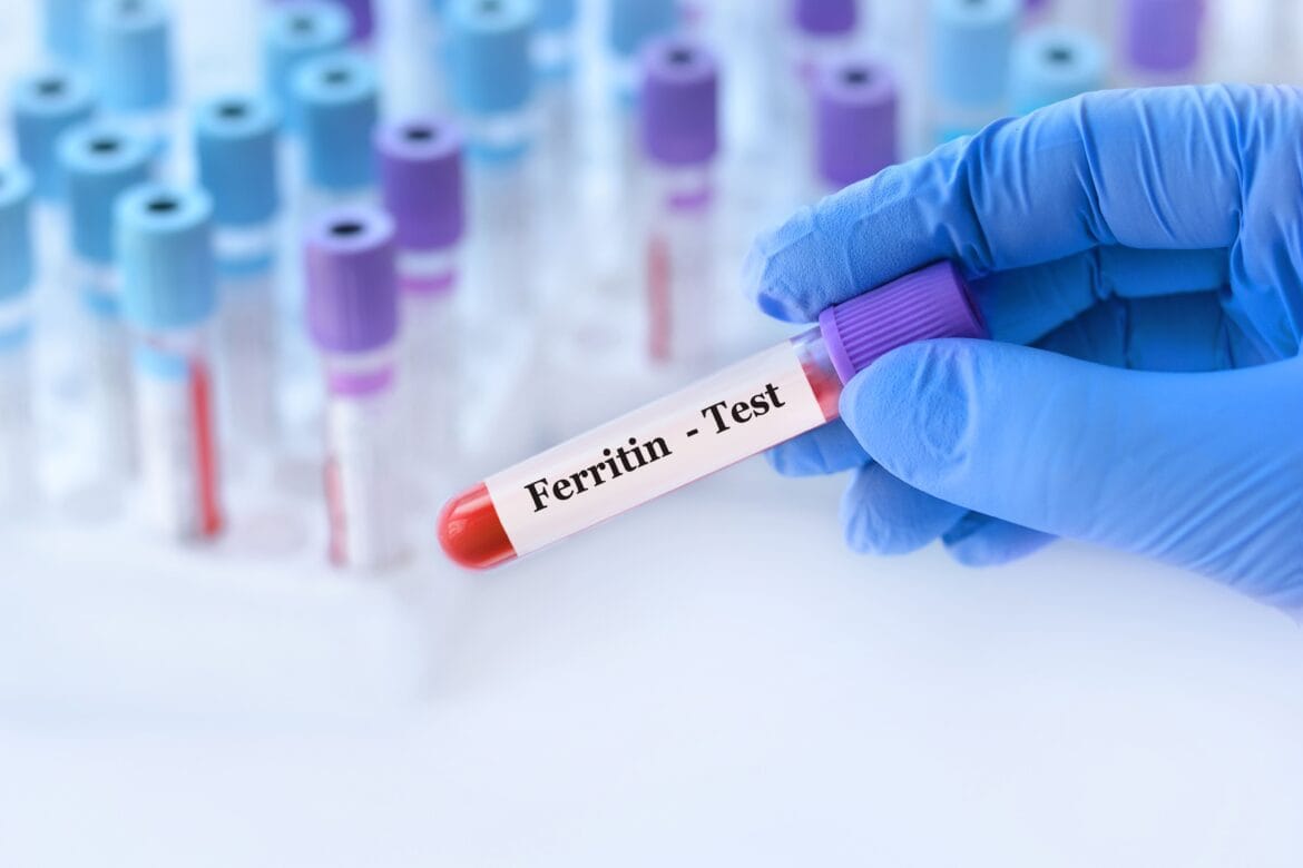 tes ferritin adalah