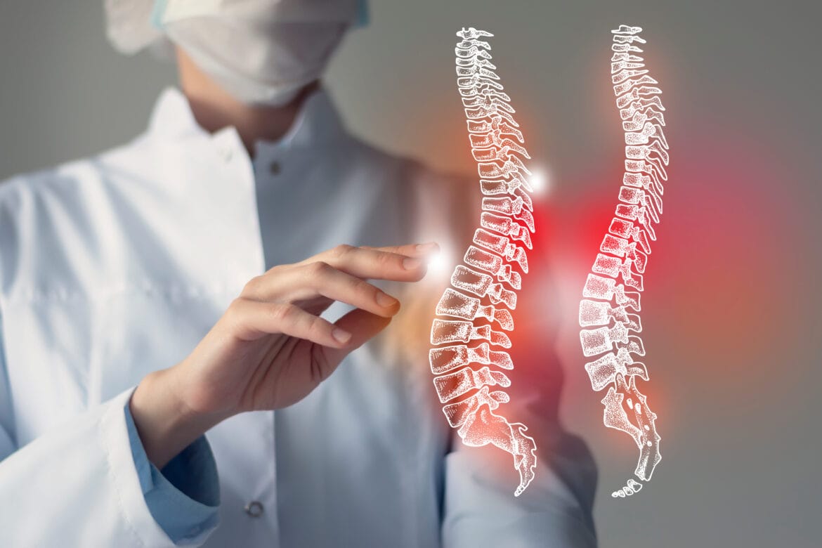 lordosis adalah
