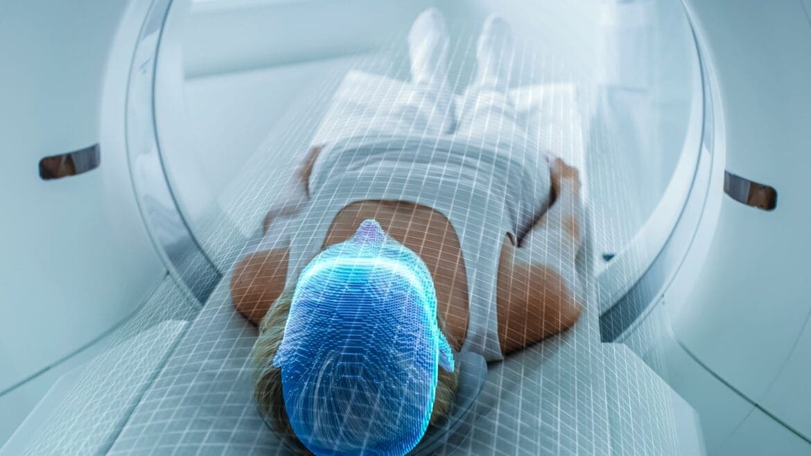 PET scan adalah