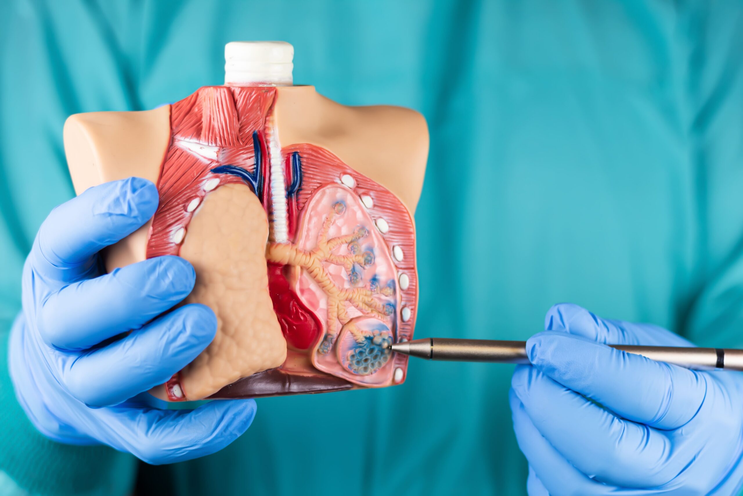 Fungsi alveolus